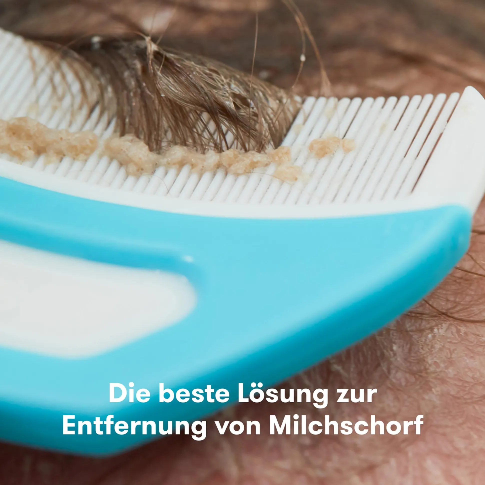 Flake Fixer 3in1 Milchschorf-Set