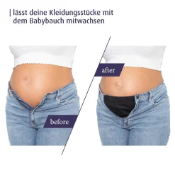 Hosenerweiterungs-Set